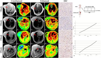 Detection of PD-L1 expression levels in malignant pleural mesothelioma with a targeted MRI nanoprobe in vivo